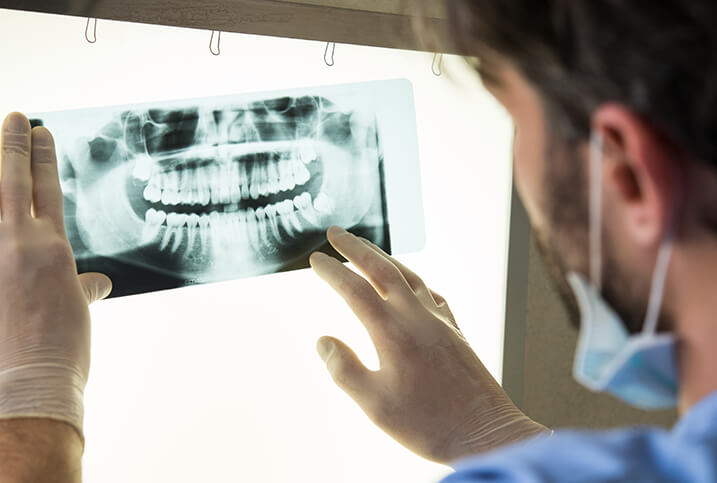 dentist looking at an x-ray of a patients teeth