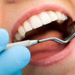 Closeup of a woman with diabetes having her oral health examined at the dentist
